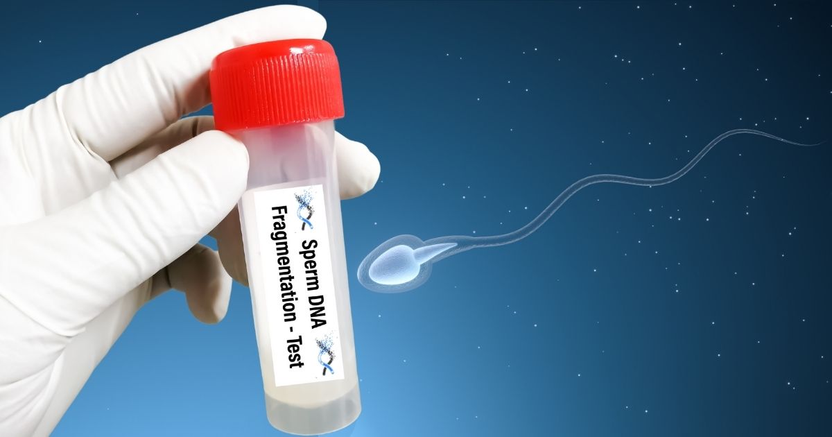 fragmentacia dna v spermiach - test